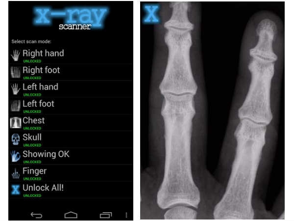 X-Ray